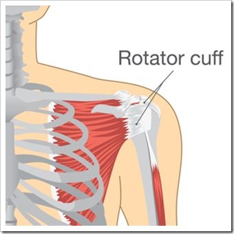 Shoulder Pain Billings MT Rotator Cuff Injury